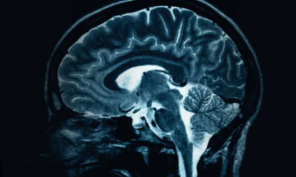 Sports Psychology - MRI of healthy brain